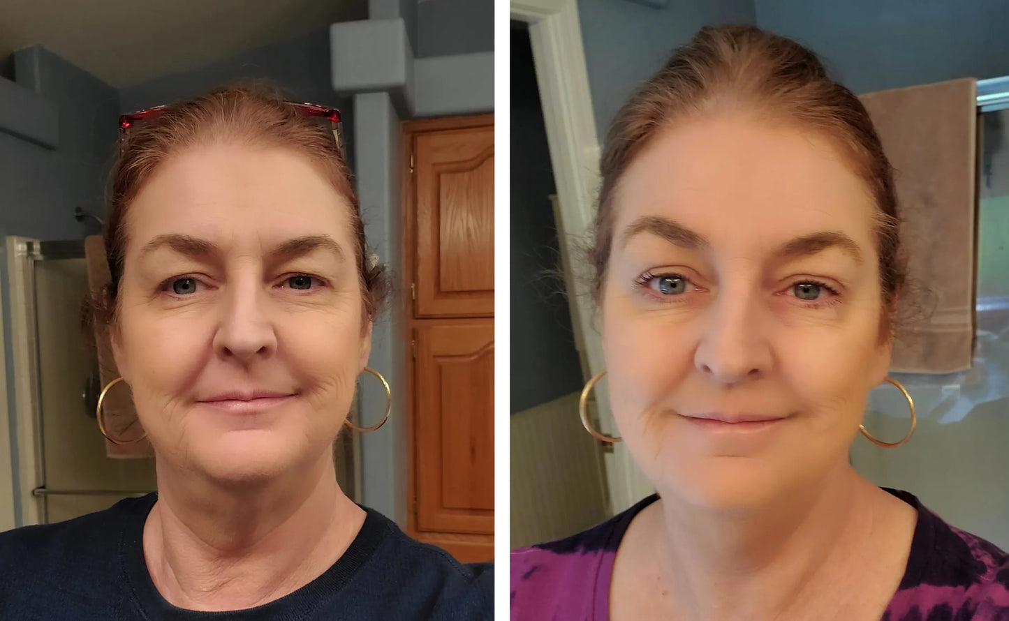 💄New Lifting - Rejuvenece Miradas- 600pares +DSCTO en SPA 💄